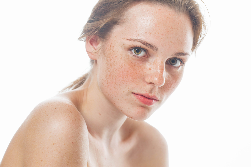 Conoce las causas de las manchas en la piel y sus tratamientos